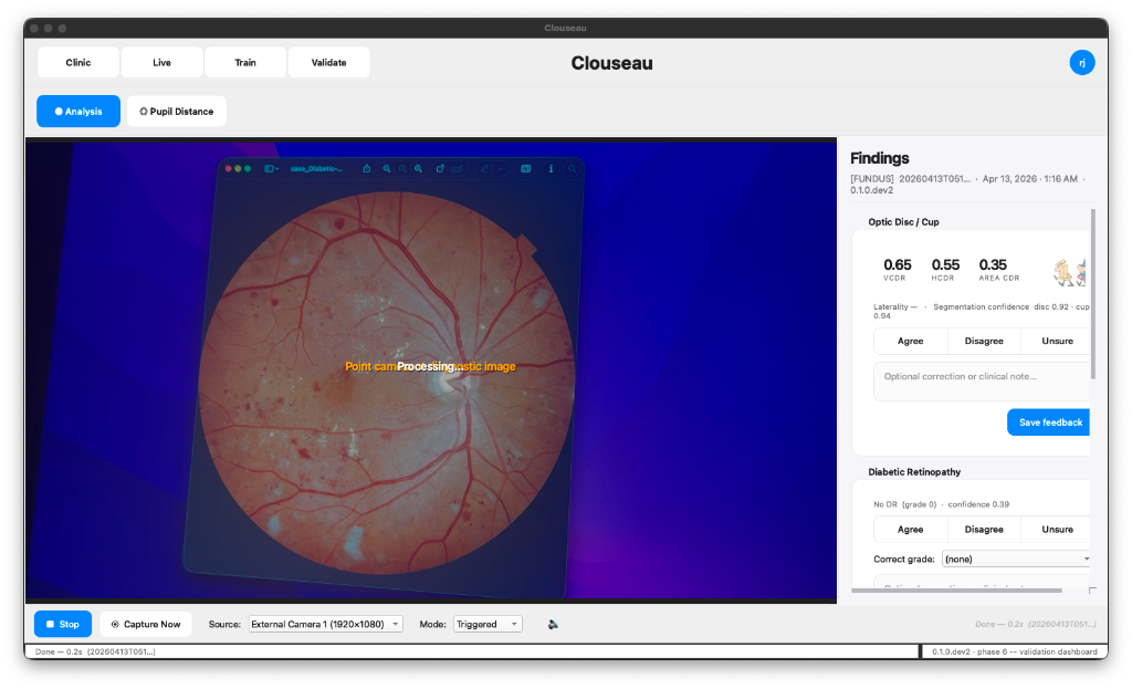 Clouseau analysis interface